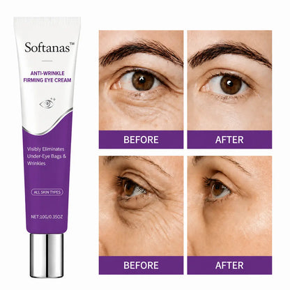Softanas™ Instant Face Temporary Tightener – Instant visible results in 30 seconds