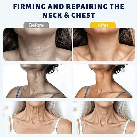 ✨ Softanas™ Instant Neck Lift Cream — 🧴 Infused with Retinol & Hyaluronic Acid | Firms the Neck, Reduces Wrinkles & Double Chin