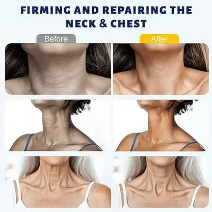 ✨ Softanas™ Instant Neck Lift Cream — 🧴 Infused with Retinol & Hyaluronic Acid | Firms the Neck, Reduces Wrinkles & Double Chin