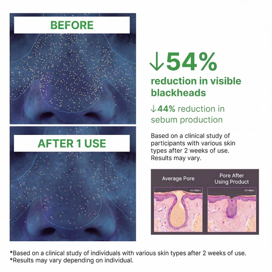 Softanas™ - Holy Basil Bubble Deep Mask