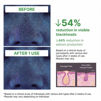 Softanas™ - Holy Basil Bubble Deep Mask