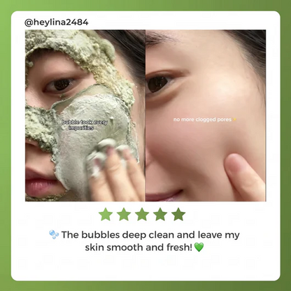 Softanas™ - Holy Basil Bubble Deep Mask
