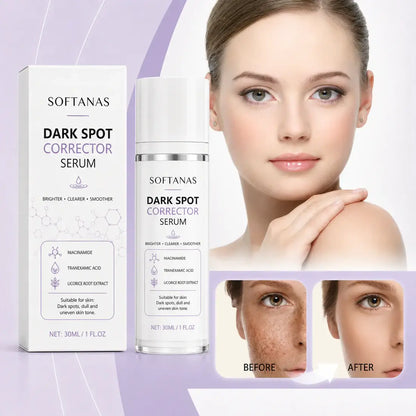 🔥Limited Time Offer🔥SOFTANAS Advanced Dark Spot Corrector Serum -Multi-Correction Brightening Formulafor Sun Spots, Age Spots, and Melasma