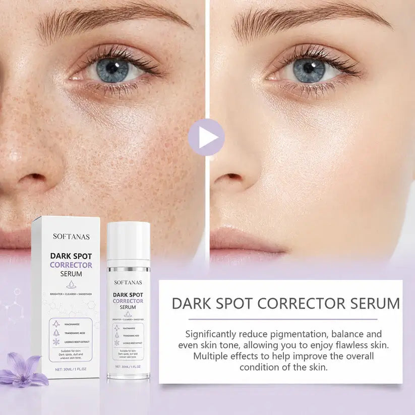 🔥Limited Time Offer🔥SOFTANAS Advanced Dark Spot Corrector Serum -Multi-Correction Brightening Formulafor Sun Spots, Age Spots, and Melasma