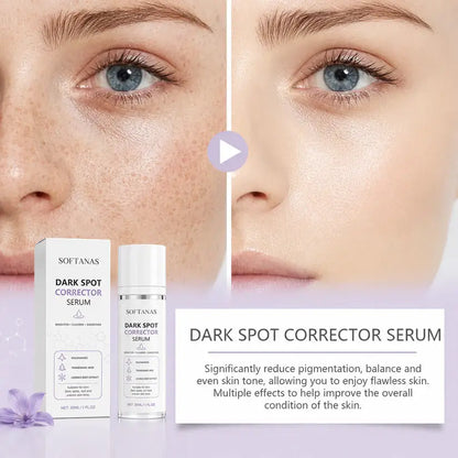 🔥Limited Time Offer🔥SOFTANAS Advanced Dark Spot Corrector Serum -Multi-Correction Brightening Formulafor Sun Spots, Age Spots, and Melasma