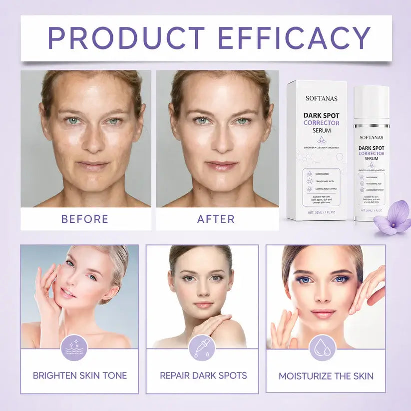🔥Limited Time Offer🔥SOFTANAS Advanced Dark Spot Corrector Serum -Multi-Correction Brightening Formulafor Sun Spots, Age Spots, and Melasma