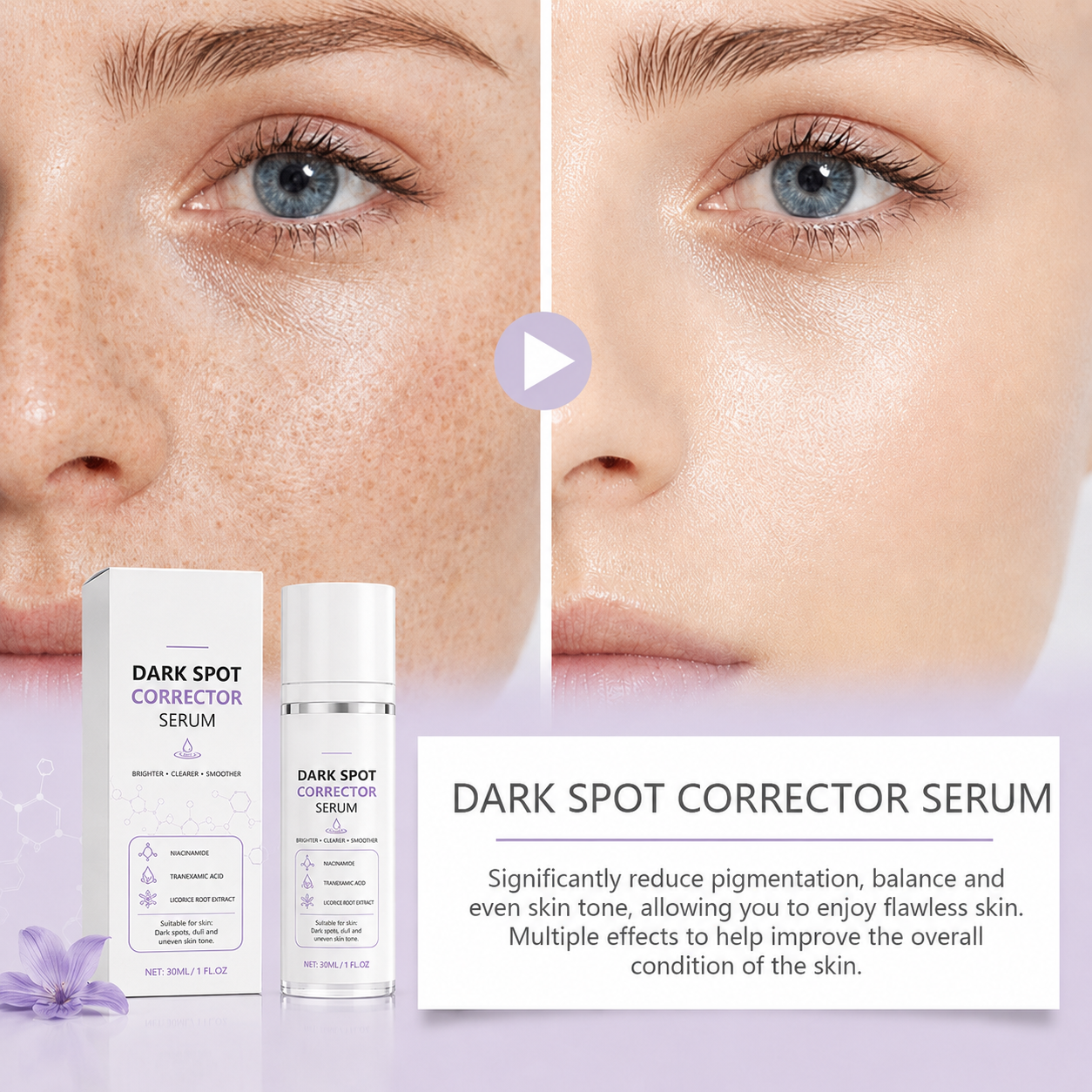 Limited Time Offer🔥Advanced Dark Spot Corrector Serum -Multi-Correction Brightening Formulafor Sun Spots, Age Spots, and Melasma
