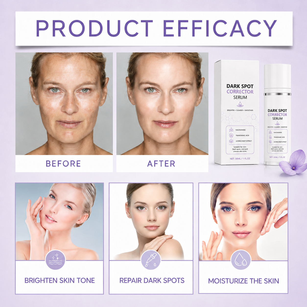 Limited Time Offer🔥Advanced Dark Spot Corrector Serum -Multi-Correction Brightening Formulafor Sun Spots, Age Spots, and Melasma