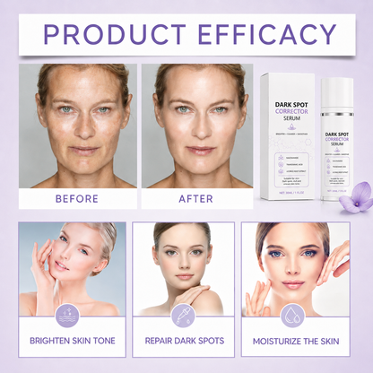 Limited Time Offer🔥Advanced Dark Spot Corrector Serum -Multi-Correction Brightening Formulafor Sun Spots, Age Spots, and Melasma