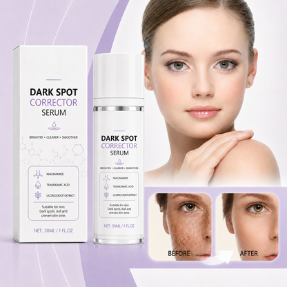 Limited Time Offer🔥Advanced Dark Spot Corrector Serum -Multi-Correction Brightening Formulafor Sun Spots, Age Spots, and Melasma