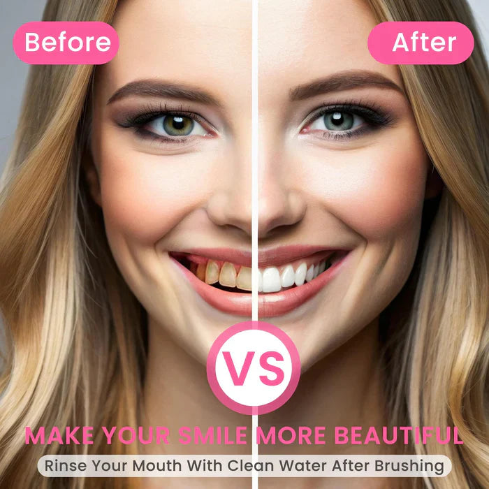SOFTANAS Triple Fluoride-Free Whitening Niacinamide Toothpaste