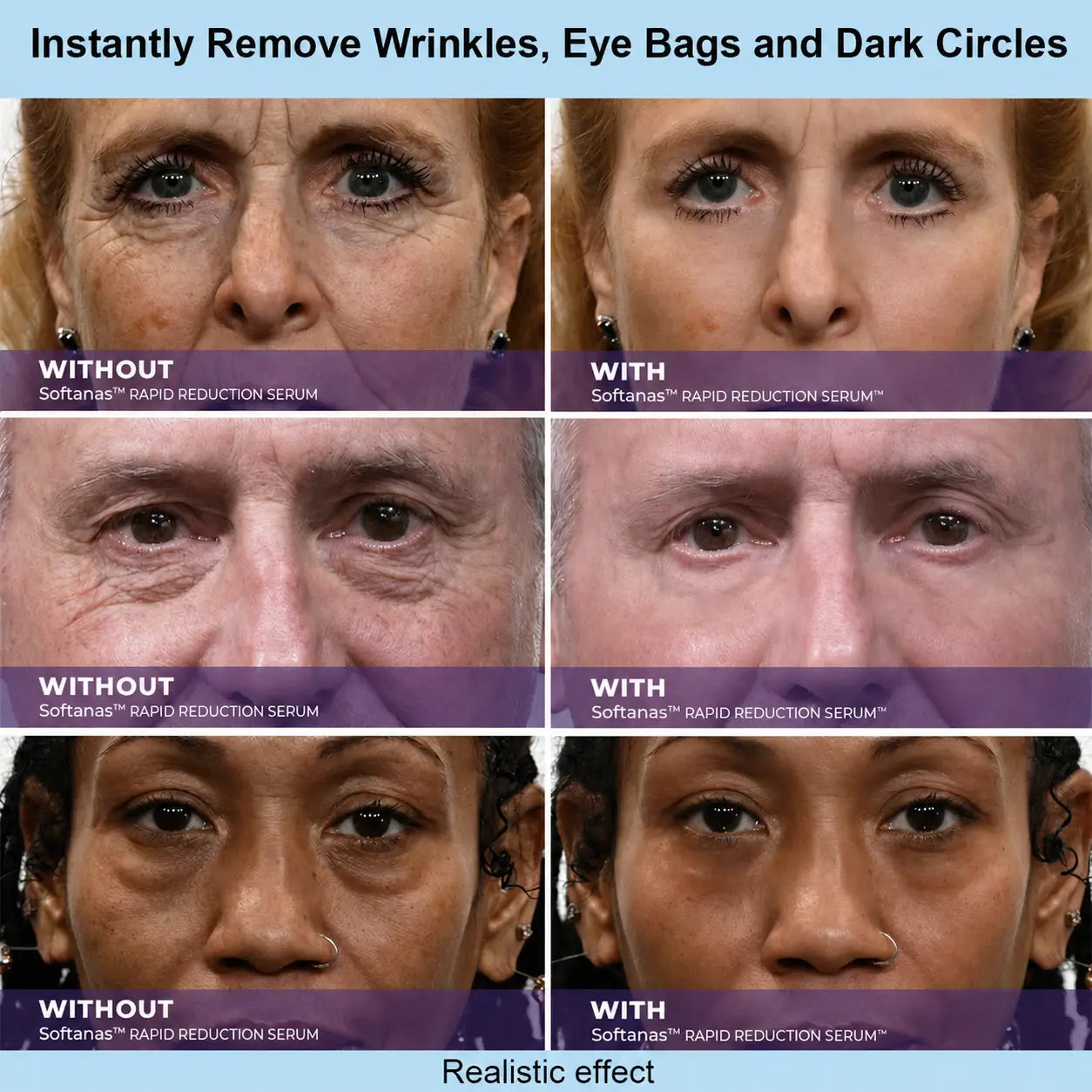 Softanas™ Instant Face Temporary Tightener – Instant visible results in 30 seconds