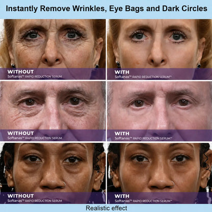 Softanas™ Instant Face Temporary Tightener – Instant visible results in 30 seconds