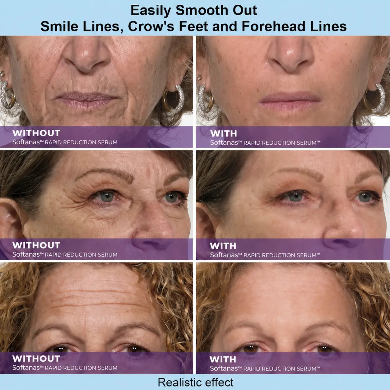 Softanas™ Instant Face Temporary Tightener – Instant visible results in 30 seconds