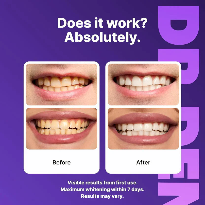 🦷Purple Instant Teeth Whitening Strips| Professional Whitening at Home