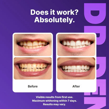 🦷Purple Instant Teeth Whitening Strips| Professional Whitening at Home